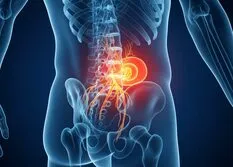Lower back pain illustration