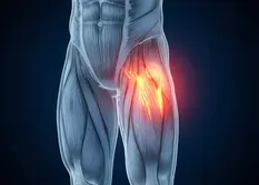 Hip and leg pain illustration