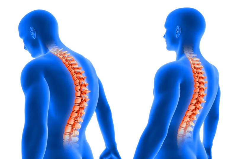 approach__spine